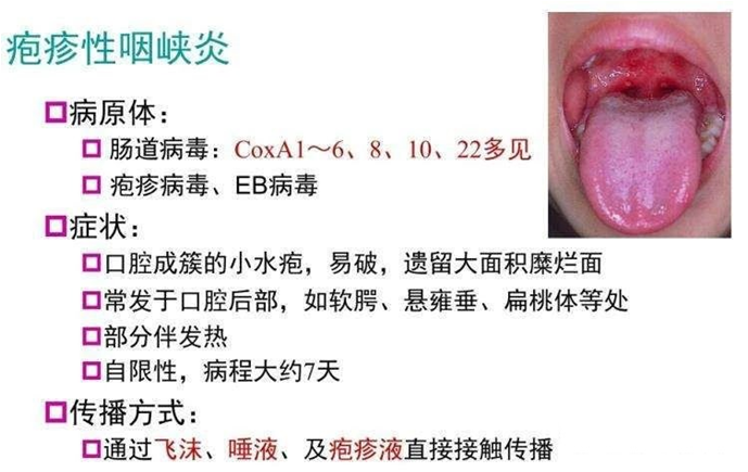 病 手足 唇
